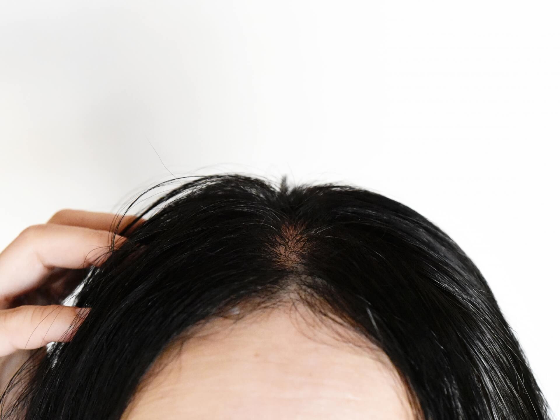 女性の薄毛の原因